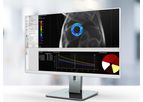 Caas - Version MR - Tissue Characterization Software