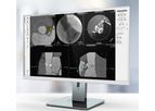 3mensio - Aortic Valve Replacement Software