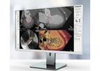 3mensio - Mitral Valve Regurgitation Software