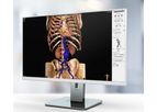 3mensio - Vascular Surgery Software