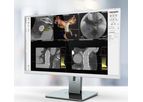 3mensio - Percutaneous Pulmonary Valve Implantation (PPVI)  Planning Software