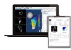 3d-Shaper - Dual-Energy X-ray Absorptiometry (DXA) Scan Software