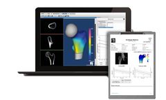 3d-Shaper - Dual-Energy X-ray Absorptiometry (DXA) Scan Software
