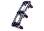 Ambassador - Anterior Cervical Plate System