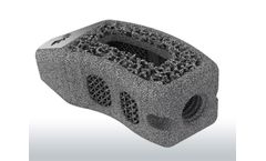 Tigershark Threaded - Model TL - Printed Curved Interbody System