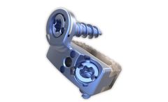 Choice Spine - Model TOMCAT - Stand-Alone Cervical Spinal System
