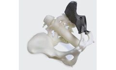 3D Medical - Part Pelvis Replacement