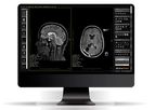 Alma - Version 2D - Advanced, Multimodality DICOM Viewer