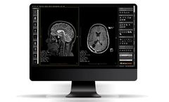 Alma - Version 2D - Advanced, Multimodality DICOM Viewer
