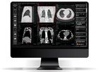 Alma - Version Multiplanar Reconstruction (MPR) - DICOM viewer