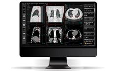 Alma - Version Multiplanar Reconstruction (MPR) - DICOM viewer