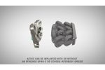 ALTIVO 2H Cervical Plate - Video