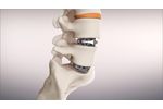 The SPIRA Open Matrix ALIF - Video