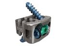 Spira - Model C - Integrated Fixation System