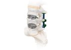Spira - Model OLIF - Open Matrix Implant