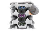 IRIS - Anterior Cervical Plate System