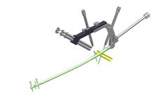 MAKALU - Expert Femur Nailing System