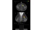 Lunit - Version INSIGHT MMG - Mammography AI Solutions