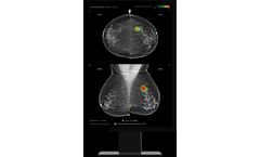 Lunit - Version INSIGHT MMG - Mammography AI Solutions