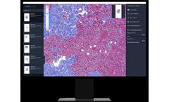 Lunit - Version SCOPE IO - AI-Powered Biomarker for Immuno-Oncology