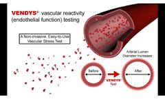 VENDYS - Endothelial Function Measurement Explained - Video