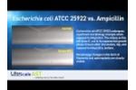Ecoli vs Ampicillin - Video