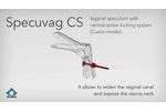 Specuvag CS - Video