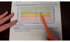 Sunlight MiniOmni Bone Density Scanner - Training 5 - RESULTS Measurement Report - Video