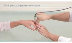 Osteoporosis Assessment by Measuring the Phalanx - Video