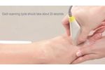 Step 6: Scan a Patient (Metatarsal) - Video