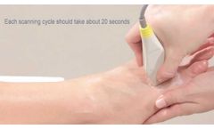 Step 6: Scan a Patient (Metatarsal) - Video