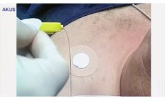 Epidural  - Video