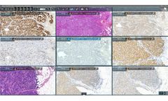 ClinicalViewer - Digital Microscopy Examination Process Software