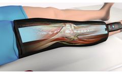 Game Ready Clinical Animation - Video