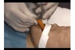 Universal Bite Block A - Video