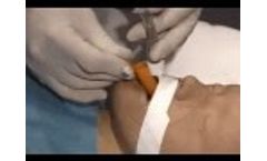 Universal Bite Block A - Video