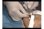 B&B Medical Technologies Universal Bite Block (Adult/Pediatric) - Video