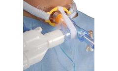 TrachStay - Stabilizes Ventilator Connector and Stabilizes In-Line Suction Devices