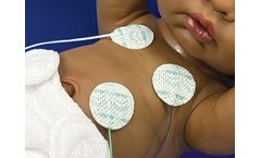 Radiolucent NeoLead - ECG Electrodes