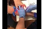 Student Nurse uses Veinlite LED+ on First Stick - Video