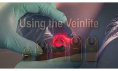 Veinlite Directions for Use - Video