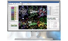Version Flare - Single Platform for Ligand-based and Structure-based Drug Design
