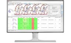 Version Spark - Desktop and Server-based Solutions