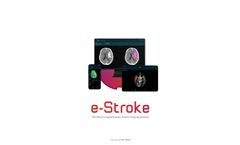 Brainomix - Version e-Stroke - Most Comprehensive Stroke Imaging Solution Brochure