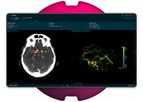 Brainomix - Version e-CTA - Advanced Solutions to Support Stroke Treatment Decisions
