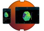 Brainomix - Version e-CTP - Robust, Reliable CT Perfusion Results
