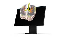 Brainomix - Version e-ILD - AI-Powered Solution for Assessment of Interstitial Lung Disease (ILD)