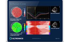 Ultromics - Version EchoGo Core - Software for Automate LV Analysis with Zero Variability