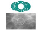 Spee-D-Ring - 3D Digital Breast Tomosynthesis Mammography Mole Marker