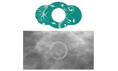 Spee-D-Ring - 3D Digital Breast Tomosynthesis Mammography Mole Marker